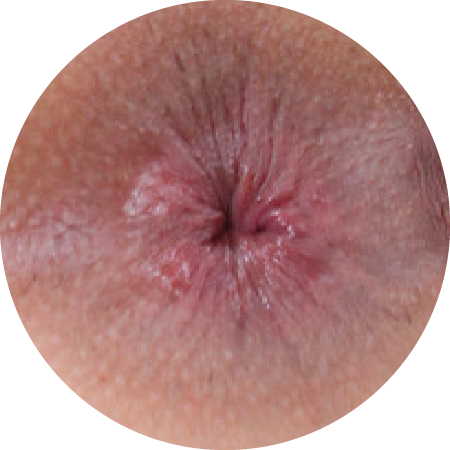 asshole #3 asshole #3