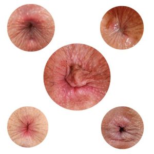 10 Anus Stickers: Spice Up Your Surface with Sass